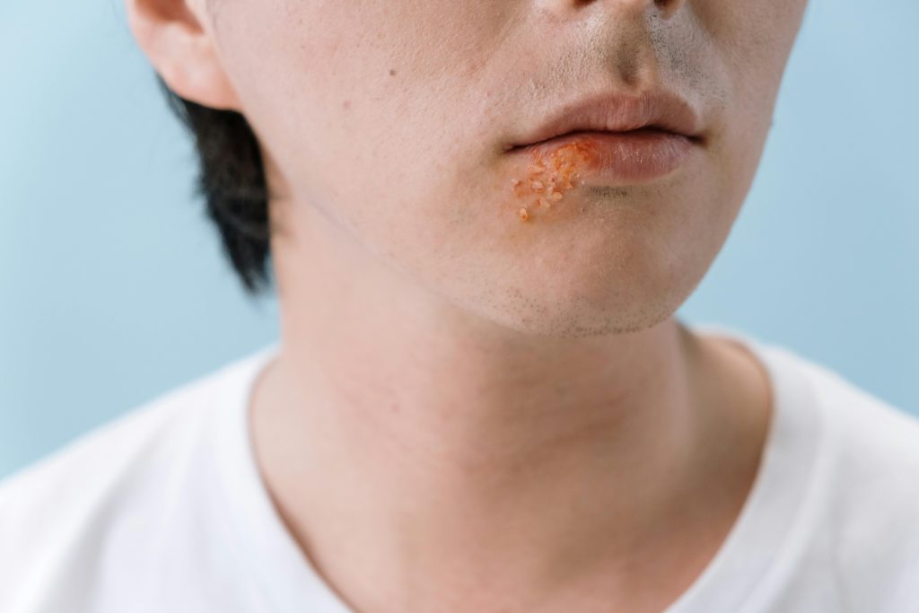 dermatologist-for-skin-infections-medi-derm-clinic