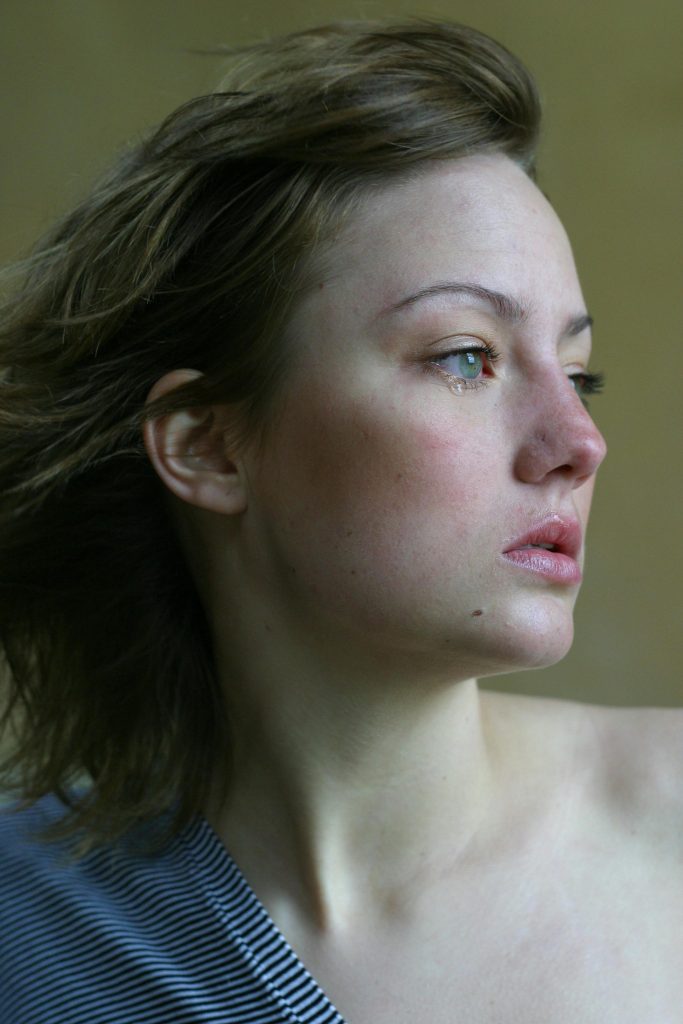 dermatologist-for-rosacea-in-hertfordshire