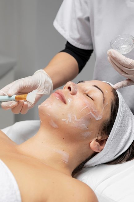 peels_acne-img